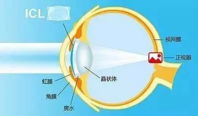 图片13.png